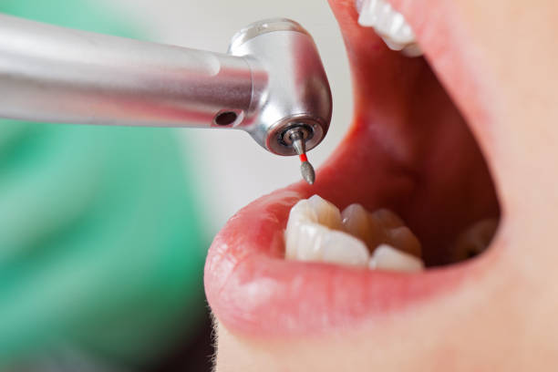 Best Tooth Infection Emergency Dentist  in Chesilhurst, NJ